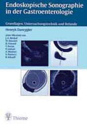 Endoskopische Sonographie in der Gastroenterologie: Grundlagen, Untersuchungstechnik und Befunde