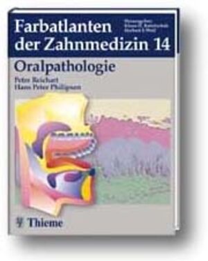 Farbatlanten der Zahnmedizin, Bd.14, Oralpathologie