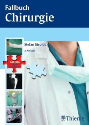 Fallbuch Chirurgie: Die 140 wichtigsten Fälle - vom Abszess bis zum Zenker-Divertikel