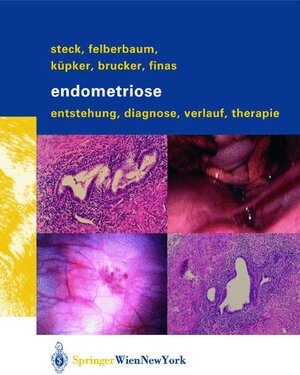 Endometriose: Entstehung, Diagnose, Verlauf und Therapie