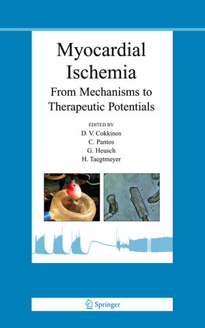 Buchcover Myocardial Ischemia  | EAN 9780387286570 | ISBN 0-387-28657-8 | ISBN 978-0-387-28657-0