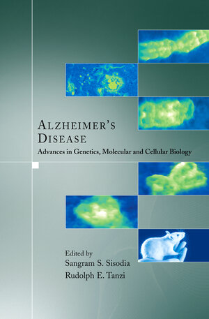 Buchcover Alzheimer's Disease  | EAN 9780387351346 | ISBN 0-387-35134-5 | ISBN 978-0-387-35134-6