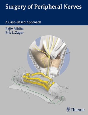 Buchcover Surgery of Peripheral Nerves | Rajiv Midha | EAN 9780865778603 | ISBN 0-86577-860-4 | ISBN 978-0-86577-860-3