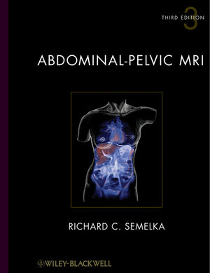 Buchcover Abdominal-Pelvic MRI | Richard C. Semelka | EAN 9781118211380 | ISBN 1-118-21138-3 | ISBN 978-1-118-21138-0