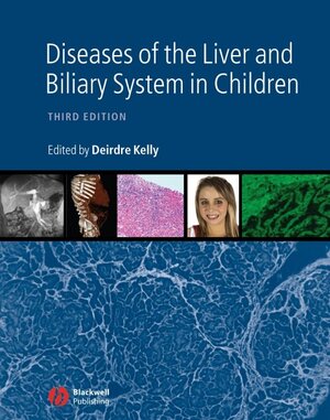 Buchcover Diseases of the Liver and Biliary System in Children | Deirdre A. Kelly | EAN 9781405163347 | ISBN 1-4051-6334-8 | ISBN 978-1-4051-6334-7