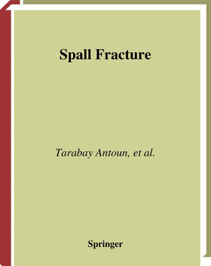 Buchcover Spall Fracture | Tarabay Antoun | EAN 9781441930286 | ISBN 1-4419-3028-0 | ISBN 978-1-4419-3028-6