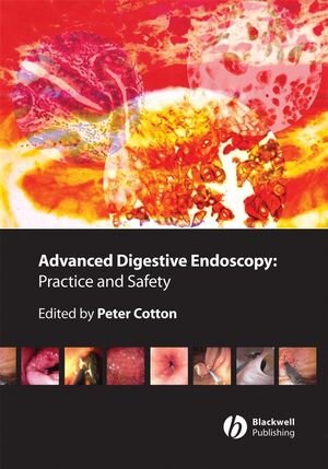 Buchcover Advanced Digestive Endoscopy | EAN 9781444300277 | ISBN 1-4443-0027-X | ISBN 978-1-4443-0027-7