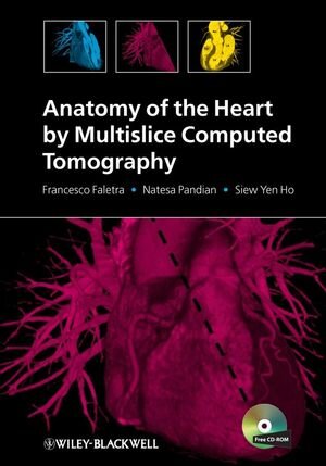Buchcover Anatomy of the Heart by Multislice Computed Tomography | Francesco Faletra | EAN 9781444300567 | ISBN 1-4443-0056-3 | ISBN 978-1-4443-0056-7