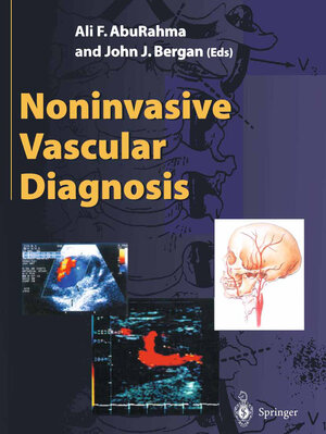 Buchcover Noninvasive Vascular Diagnosis  | EAN 9781447138372 | ISBN 1-4471-3837-6 | ISBN 978-1-4471-3837-2