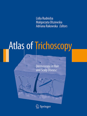 Buchcover Atlas of Trichoscopy | EAN 9781447170082 | ISBN 1-4471-7008-3 | ISBN 978-1-4471-7008-2