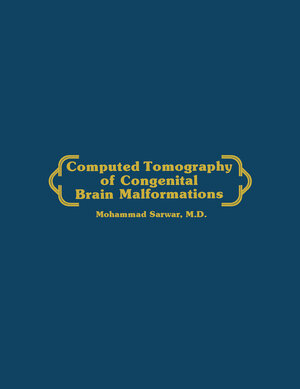 Buchcover Computed Tomography of Congenital Brain Malformations | Mohammed Sarwar | EAN 9781461325710 | ISBN 1-4613-2571-4 | ISBN 978-1-4613-2571-0