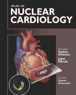 Buchcover Atlas of Nuclear Cardiology | EAN 9781461564966 | ISBN 1-4615-6496-4 | ISBN 978-1-4615-6496-6