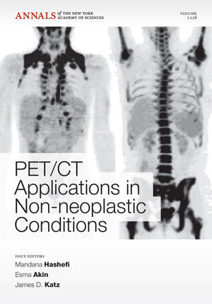 Buchcover PET CT Applications in Non-Neoplastic Conditions  | EAN 9781573318181 | ISBN 1-57331-818-3 | ISBN 978-1-57331-818-1