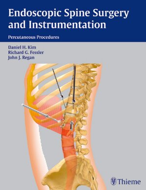 Buchcover Endoscopic Spine Surgery and Instrumentation | EAN 9781588902252 | ISBN 1-58890-225-0 | ISBN 978-1-58890-225-2