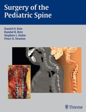 Buchcover Surgery of the Pediatric Spine | Lawrence G Lenke | EAN 9781588903426 | ISBN 1-58890-342-7 | ISBN 978-1-58890-342-6