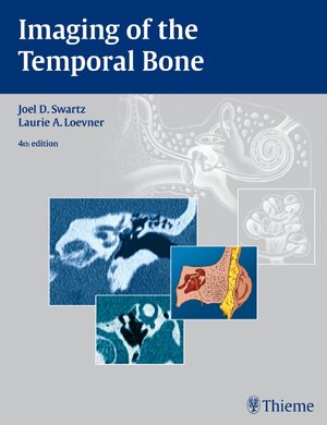 Buchcover Imaging of the Temporal Bone | EAN 9781588903457 | ISBN 1-58890-345-1 | ISBN 978-1-58890-345-7
