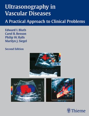 Buchcover Ultrasonography in Vascular Diseases | Edward I. Bluth | EAN 9781588906106 | ISBN 1-58890-610-8 | ISBN 978-1-58890-610-6