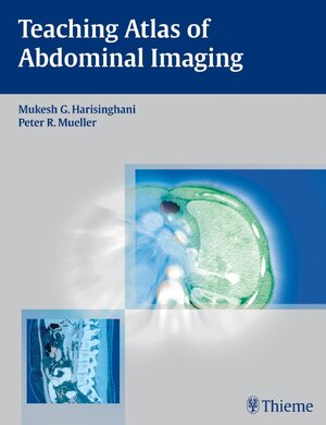 Buchcover Teaching Atlas of Abdominal Imaging | Mukesh G. Harisinghani | EAN 9781588906465 | ISBN 1-58890-646-9 | ISBN 978-1-58890-646-5