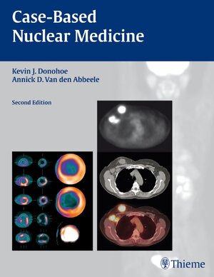 Buchcover Case-Based Nuclear Medicine  | EAN 9781588906526 | ISBN 1-58890-652-3 | ISBN 978-1-58890-652-6
