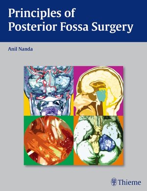 Buchcover Principles of Posterior Fossa Surgery  | EAN 9781588906632 | ISBN 1-58890-663-9 | ISBN 978-1-58890-663-2