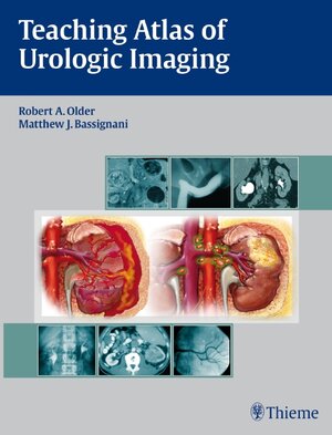 Buchcover Teaching Atlas of Urologic Imaging | EAN 9781604060164 | ISBN 1-60406-016-6 | ISBN 978-1-60406-016-4