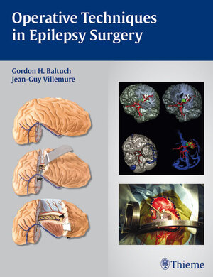 Buchcover Techniques of Epilepsy Surgery | Gordon H. Baltuch | EAN 9781604060911 | ISBN 1-60406-091-3 | ISBN 978-1-60406-091-1