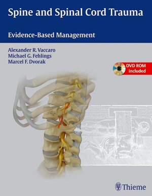 Buchcover Spine and Spinal Cord Trauma | Alexander R. Vaccaro | EAN 9781604062212 | ISBN 1-60406-221-5 | ISBN 978-1-60406-221-2