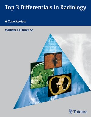 Buchcover Top 3 Differentials in Radiology | William T. O'Brien | EAN 9781604062267 | ISBN 1-60406-226-6 | ISBN 978-1-60406-226-7