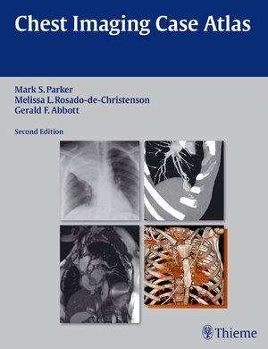 Buchcover Chest Imaging Case Atlas | Mark S. Parker | EAN 9781604065909 | ISBN 1-60406-590-7 | ISBN 978-1-60406-590-9
