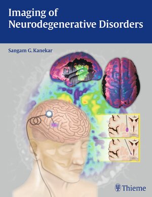 Buchcover Imaging of Neurodegenerative Disorders | EAN 9781604068559 | ISBN 1-60406-855-8 | ISBN 978-1-60406-855-9