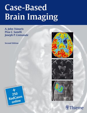 Buchcover Case-Based Brain Imaging | Apostolos John Tsiouris | EAN 9781604069532 | ISBN 1-60406-953-8 | ISBN 978-1-60406-953-2