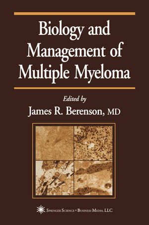 Buchcover Biology and Management of Multiple Myeloma | EAN 9781617371431 | ISBN 1-61737-143-2 | ISBN 978-1-61737-143-1