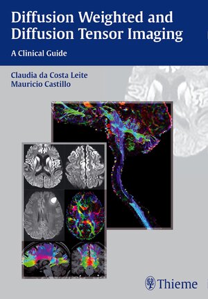 Buchcover Diffusion Weighted and Diffusion Tensor Imaging | EAN 9781626230217 | ISBN 1-62623-021-8 | ISBN 978-1-62623-021-7