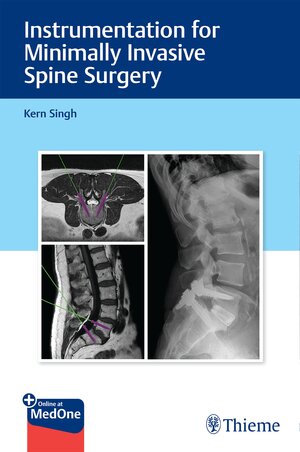 Buchcover Instrumentation for Minimally Invasive Spine Surgery | Kern Singh | EAN 9781626232037 | ISBN 1-62623-203-2 | ISBN 978-1-62623-203-7