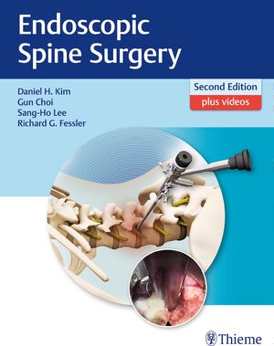 Buchcover Endoscopic Spine Surgery  | EAN 9781626232648 | ISBN 1-62623-264-4 | ISBN 978-1-62623-264-8