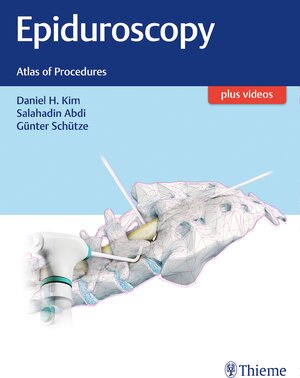 Buchcover Epiduroscopy  | EAN 9781626232662 | ISBN 1-62623-266-0 | ISBN 978-1-62623-266-2