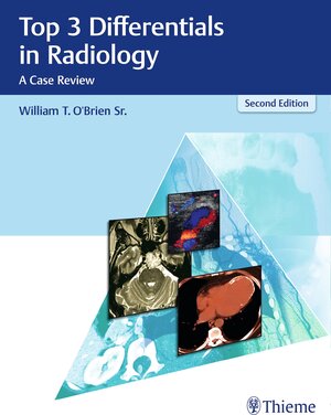 Buchcover Top 3 Differentials in Radiology | William T. O'Brien | EAN 9781626232792 | ISBN 1-62623-279-2 | ISBN 978-1-62623-279-2