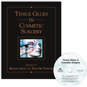 Buchcover Tissue Glues in Cosmetic Surgery  | EAN 9781626236301 | ISBN 1-62623-630-5 | ISBN 978-1-62623-630-1