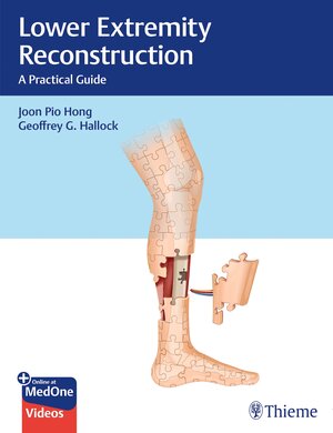 Buchcover Lower Extremity Reconstruction | Joon Pio Hong | EAN 9781626238091 | ISBN 1-62623-809-X | ISBN 978-1-62623-809-1