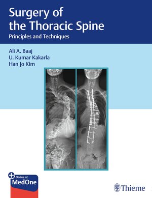 Buchcover Surgery of the Thoracic Spine | Ali A. Baaj | EAN 9781626238558 | ISBN 1-62623-855-3 | ISBN 978-1-62623-855-8