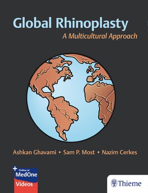Buchcover Global Rhinoplasty | Ashkan Ghavami | EAN 9781626238916 | ISBN 1-62623-891-X | ISBN 978-1-62623-891-6