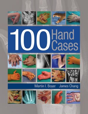 Buchcover 100 Hand Cases | Martin Boyer | EAN 9781638530015 | ISBN 1-63853-001-7 | ISBN 978-1-63853-001-5
