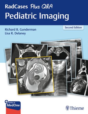 Buchcover RadCases Plus Q&A Pediatric Imaging | Richard B. Gunderman | EAN 9781638534716 | ISBN 1-63853-471-3 | ISBN 978-1-63853-471-6
