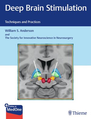 Buchcover Deep Brain Stimulation | William S. Anderson | EAN 9781638535287 | ISBN 1-63853-528-0 | ISBN 978-1-63853-528-7