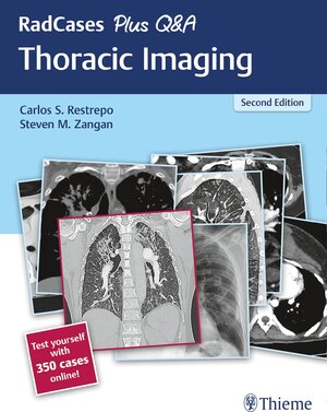 Buchcover RadCases Plus Q&A Thoracic Imaging  | EAN 9781638535331 | ISBN 1-63853-533-7 | ISBN 978-1-63853-533-1