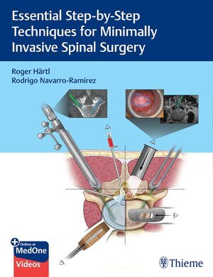 Buchcover Essential Step-by-Step Techniques for Minimally Invasive Spinal Surgery | Roger Hartl | EAN 9781684200092 | ISBN 1-68420-009-1 | ISBN 978-1-68420-009-2