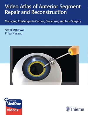 Buchcover Video Atlas of Anterior Segment Repair and Reconstruction | Amar Agarwal | EAN 9781684200979 | ISBN 1-68420-097-0 | ISBN 978-1-68420-097-9