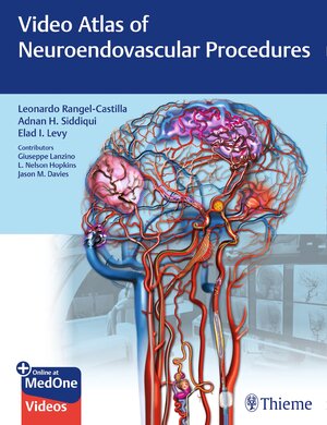 Buchcover Video Atlas of Neuroendovascular Procedures | Leonardo Rangel-Castilla | EAN 9781684201198 | ISBN 1-68420-119-5 | ISBN 978-1-68420-119-8