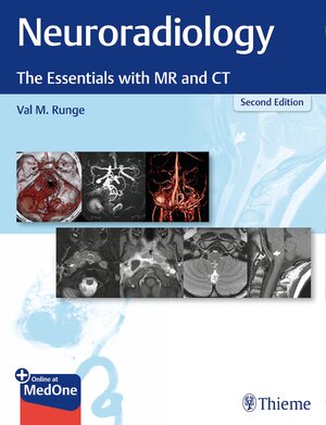Buchcover Neuroradiology | Val M. Runge | EAN 9781684201549 | ISBN 1-68420-154-3 | ISBN 978-1-68420-154-9