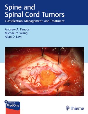 Buchcover Spine and Spinal Cord Tumors | Andrew Fanous | EAN 9781684201648 | ISBN 1-68420-164-0 | ISBN 978-1-68420-164-8